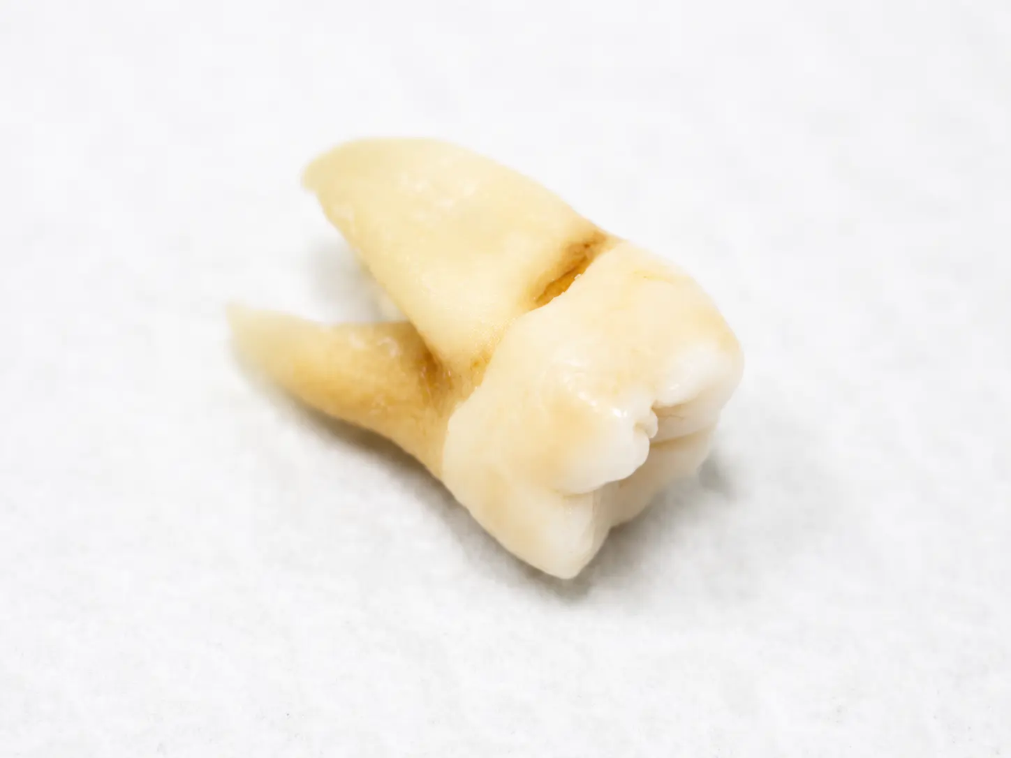 CASE 008 鑲埋好的樣品